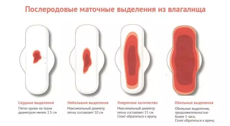 Выделения после родов